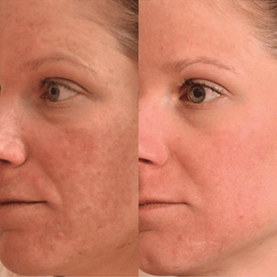 Before & After