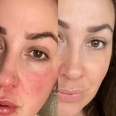 Before & After