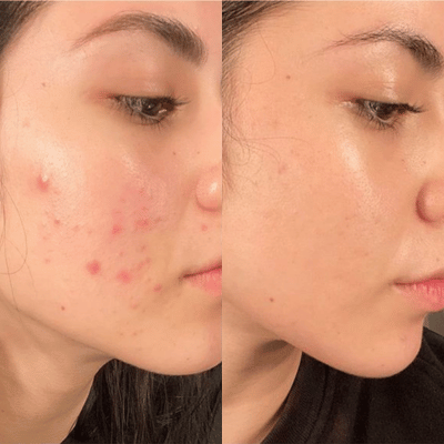 Before & After