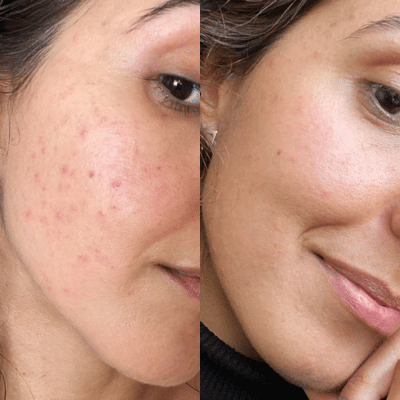 Before & After