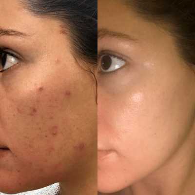 Before & After