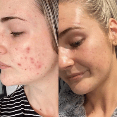 Before & After