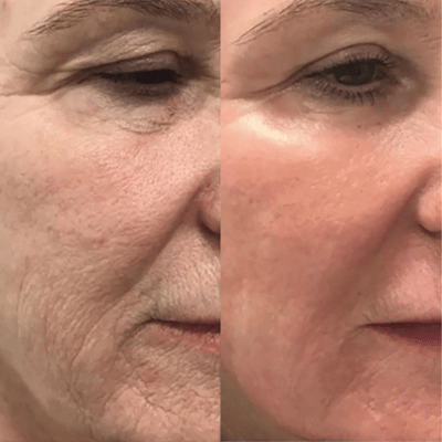 Before & After