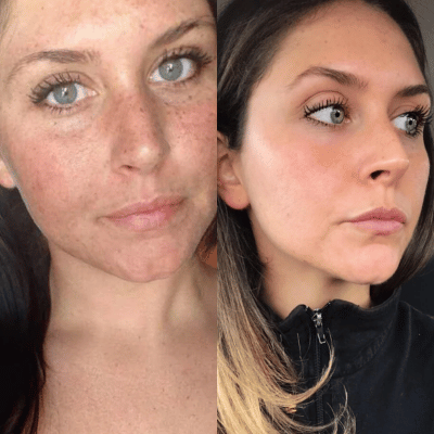 Before & After