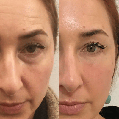 Before & After