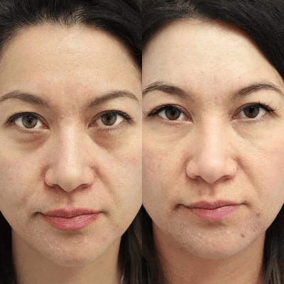 Before & After