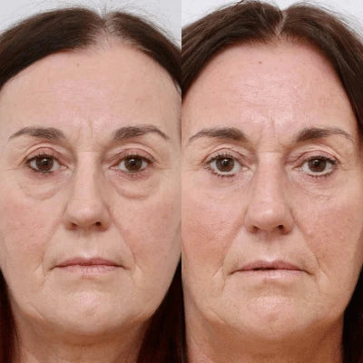 multicolumns-item-image-2