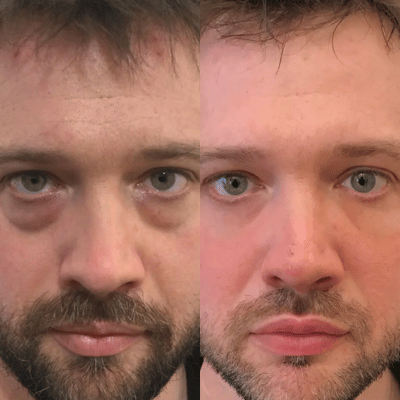 Before & After