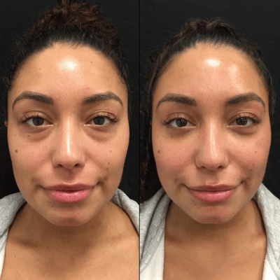 Before & After