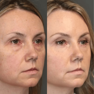 Before & After