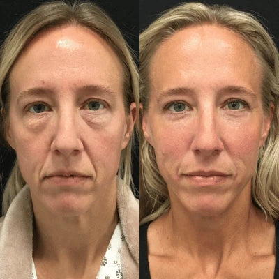 multicolumns-item-image-3