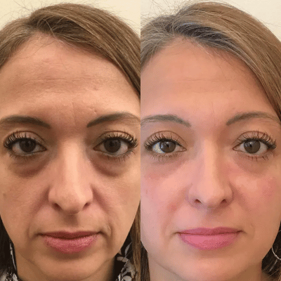 Before & After